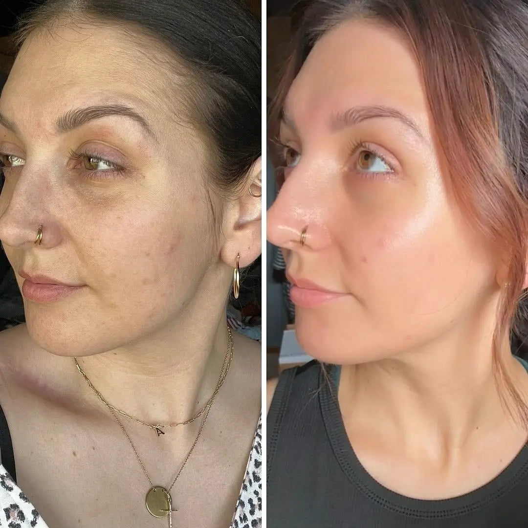 Stick Anti Ojeras Clinavé
