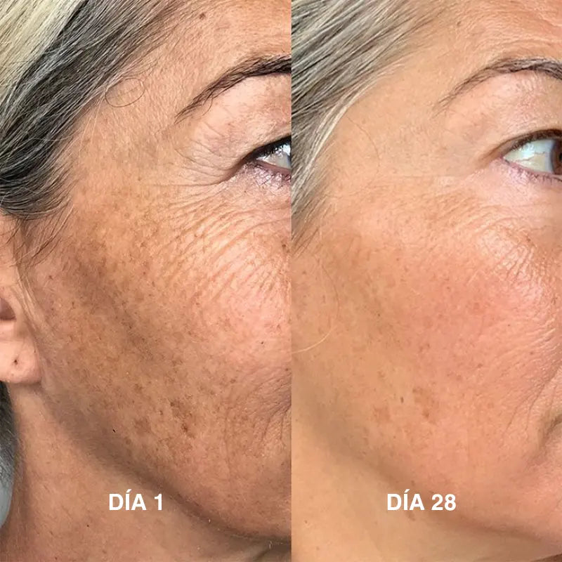 Serum Anti Manchas con Vitamina C
