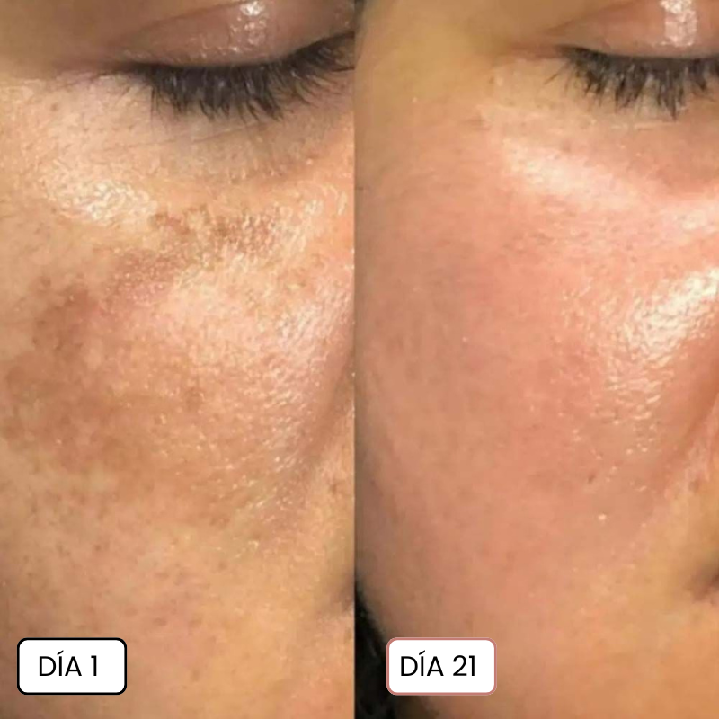 Clinavé · Crema Anti-Mancha con Acción Vascular