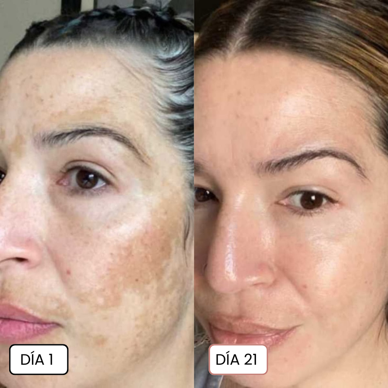 Clinavé · Crema Anti-Mancha con Acción Vascular
