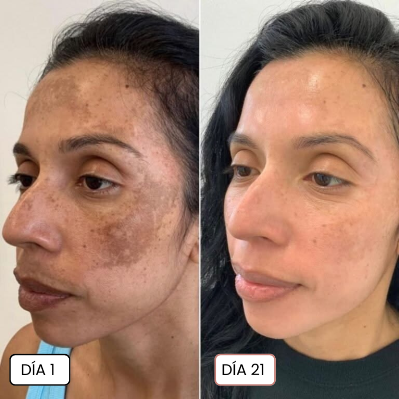 Clinavé · Crema Anti-Mancha con Acción Vascular